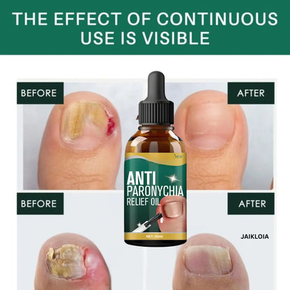 Nail Fungus Anti Paronychia Relief Oil 20 ml (Pack of 2) BUY 1 GET 1 FREE! FLAT Rs. 100 OFF on UPI Payments!